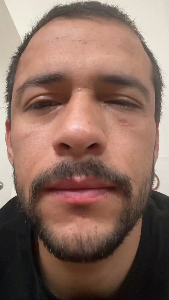 Rostro de Gilberto Guerrero antes de su transformación