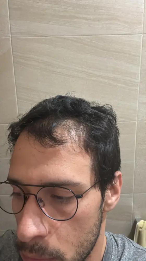 Rostro de Gilberto Guerrero antes de su transformación, con lentes
